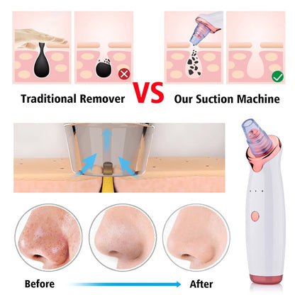 Blackhead Remover Diamond Dermabrasion Nose Vacuum Pore