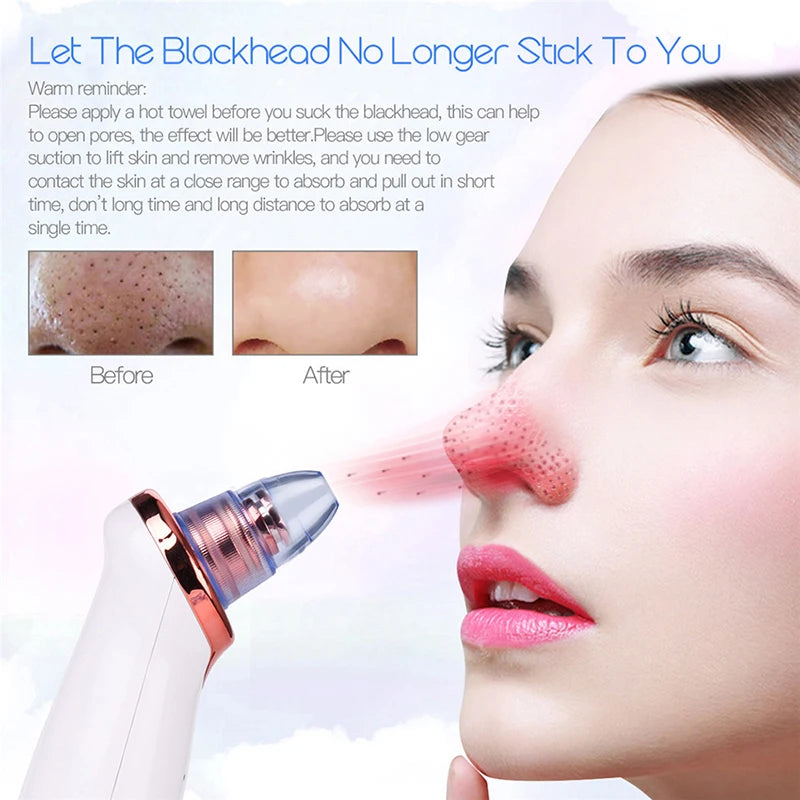 Blackhead Remover Diamond Dermabrasion Nose Vacuum Pore